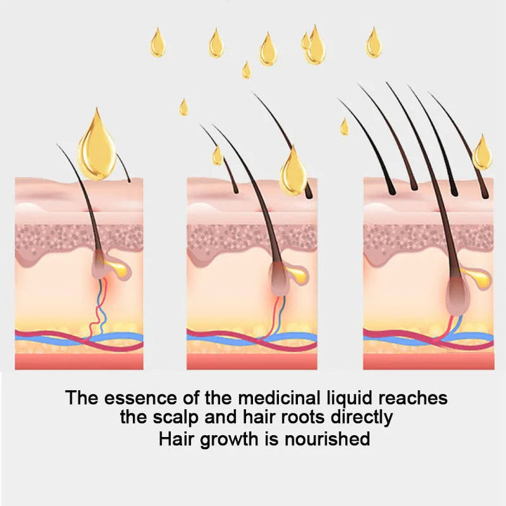 Direct Root Scalp Oil Applicator for Hair Growth